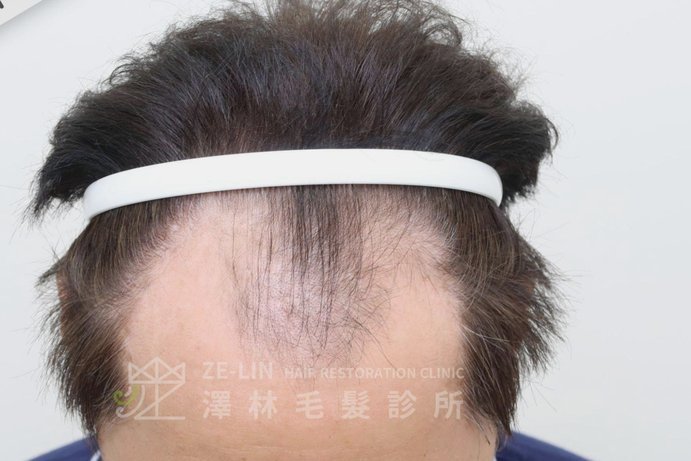 分付套现“秒回”真的靠谱吗？深度揭秘其陷阱与风险